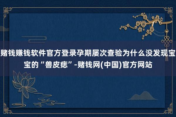 赌钱赚钱软件官方登录孕期屡次查验为什么没发现宝宝的“兽皮痣”-赌钱网(中国)官方网站